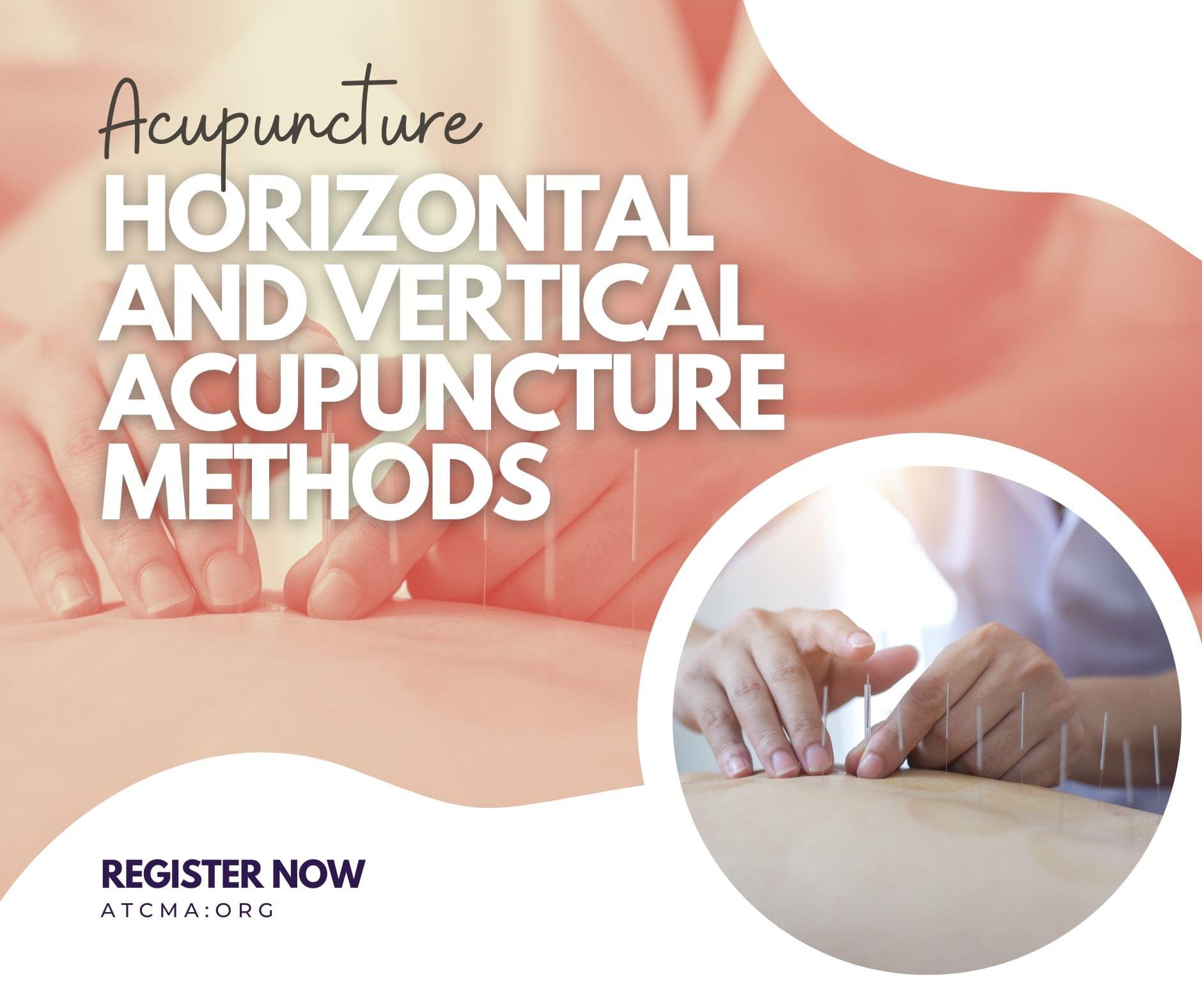 Horizontal and Vertical Acupuncture Methods