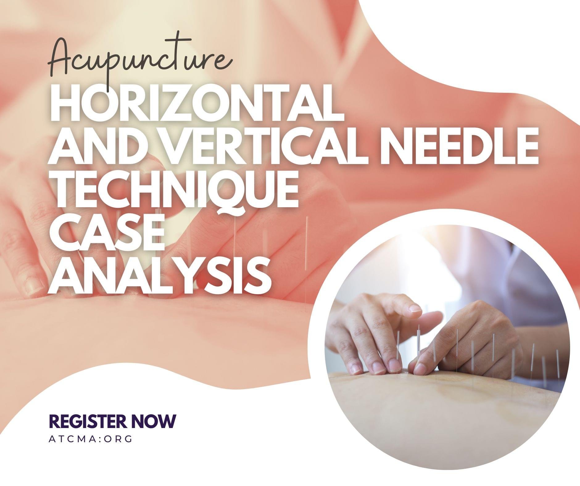 Horizontal and Vertical Needle Technique Case Analysis